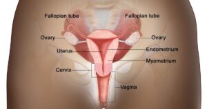 8 early signs of cervical cancer most women ignore